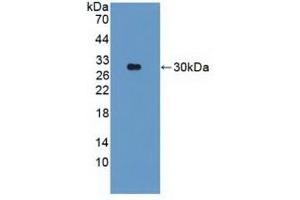 Western Blotting (WB) image for anti-Parkinson Protein 2, E3 Ubiquitin Protein Ligase (Parkin) (PARK2) (AA 229-465) antibody (ABIN7441625)