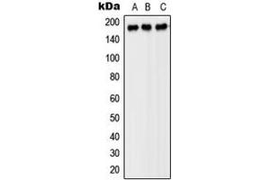 Western blot analysis of PDGFR beta expression in SP2/0 (A), H9C2 (B), PC12 (C) whole cell lysates. (PDGFRB antibody  (Center))