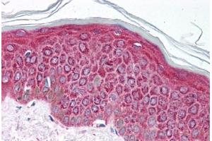 Human Skin (formalin-fixed, paraffin-embedded) stained with ETV4 antibody ABIN214103 at 5 ug/ml followed by biotinylated goat anti-rabbit IgG secondary antibody ABIN481713, alkaline phosphatase-streptavidin and chromogen. (ETV4 antibody  (AA 181-230))