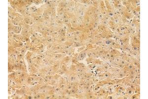 ABIN6261354 and ABIN6266951 at 1/100 staining human normal liver tissue by IHC-P.
