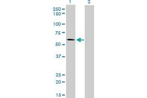 Western Blot analysis of ALPPL2 expression in transfected 293T cell line by ALPPL2 monoclonal antibody (M07), clone 2B3. (ALPPL2 antibody  (AA 365-454))