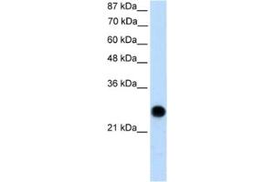 Western Blotting (WB) image for anti-Voltage-Dependent Anion Channel 2 (VDAC2) antibody (ABIN2461103)