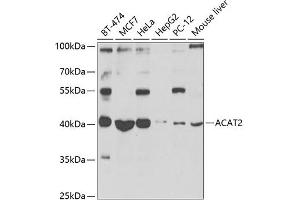 Western blot analysis of extracts of various cell lines, using  antibody (ABIN6131166, ABIN6136417, ABIN6136418 and ABIN6223845) at 1:1000 dilution. (ACAT2 antibody  (AA 1-97))