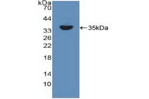 Detection of Recombinant RELB, Human using Polyclonal Antibody to V-Rel Reticuloendotheliosis Viral Oncogene Homolog B (RELB) (RELB antibody  (AA 248-492))