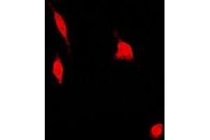 Immunofluorescent analysis of PSMA4 staining in U2OS cells. (PSMA4 antibody)