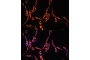 Immunofluorescence analysis of NIH/3T3 cells using KRAS antibody (ABIN3021676, ABIN3021677, ABIN3021678, ABIN1513137 and ABIN1514282) at dilution of 1:100. (K-RAS antibody)