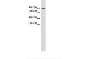 Image no. 1 for anti-EPS8-Like 1 (EPS8L1) (AA 51-100) antibody (ABIN203463) (EPS8-Like 1 antibody  (AA 51-100))