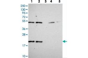 Western blot analysis of Lane 1: RT-4, Lane 2: U-251 MG, Lane 3: Human Plasma, Lane 4: Liver, Lane 5: Tonsil with KIAA1143 polyclonal antibody  at 1:250-1:500 dilution. (KIAA1143 antibody)