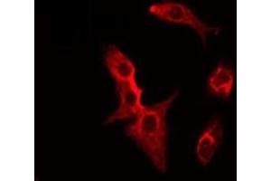 ABIN6275515 staining HeLa by IF/ICC. (SFRP2 antibody  (Internal Region))