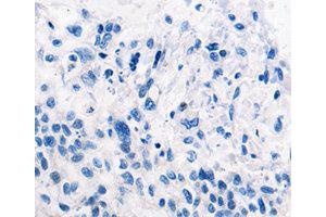 Immunohistochemistry (IHC) image for anti-Tripartite Motif Containing 63 (TRIM63) antibody (ABIN1875209) (TRIM63 antibody)