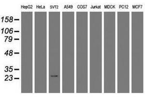 Image no. 1 for anti-Regulator of G-Protein Signaling 16 (RGS16) antibody (ABIN1500688) (RGS16 antibody)