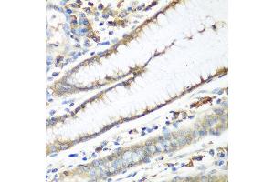 Immunohistochemistry of paraffin-embedded human stomach using CAD antibody at dilution of 1:100 (40x lens).