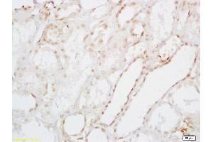 Formalin-fixed and paraffin embedded human kidney labeled with Anti-Uricase Polyclonal Antibody, Unconjugated (ABIN720385) at 1:200 followed by conjugation to the secondary antibody and DAB staining