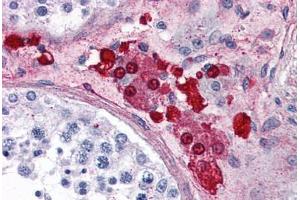 Anti-ADORA2A antibody  ABIN1048304 IHC staining of human testis.