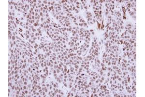 IHC-P Image Immunohistochemical analysis of paraffin-embedded KYSE170 xenograft, using RCC1, antibody at 1:500 dilution. (RCC1 antibody)