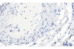 Smooth Muscle Actin antibody  (N-Term)