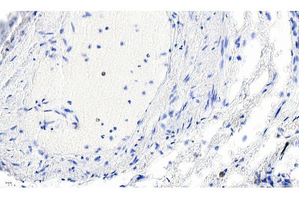 Smooth Muscle Actin antibody  (N-Term)