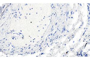 ABIN185271 Negative Control showing staining of paraffin embedded Human Lung, with no primary antibody.