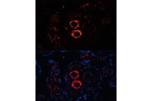 Immunofluorescence analysis of human placenta cells using SMMHC/SMMHC/MYH11 antibody (ABIN6129611, ABIN6144234, ABIN6144235 and ABIN6215005) at dilution of 1:100. (MYH11 antibody  (AA 1680-1979))