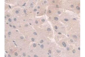 DAB staining on IHC-P; Samples: Human Liver Tissue)