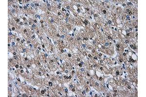 Immunohistochemical staining of paraffin-embedded liver tissue using anti-HSPA1Amouse monoclonal antibody. (HSP70 1A antibody)