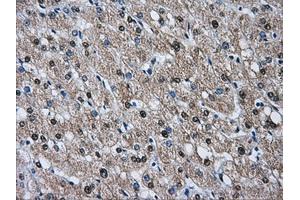 Immunohistochemical staining of paraffin-embedded liver tissue using anti-HSPA1Amouse monoclonal antibody.