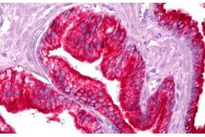Immunohistochemistry (IHC) image for anti-Keratin 18 (KRT18) antibody (FITC) (ABIN956923)