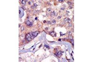 Image no. 2 for anti-Lymphocyte-Specific Protein tyrosine Kinase (LCK) (N-Term) antibody (ABIN359986) (LCK antibody  (N-Term))