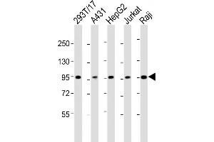 All lanes : Anti-SLC22A2 Antibody (N-term) at 1:2000 dilution Lane 1: 293T/17 whole cell lysate Lane 2: A431 whole cell lysate Lane 3: HepG2 whole cell lysate Lane 4: Jurkat whole cell lysate Lane 5: Raji whole cell lysate Lysates/proteins at 20 μg per lane.