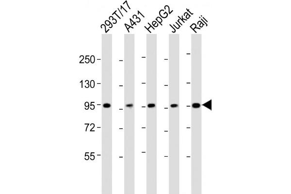 SLC22A2 anticorps  (N-Term)