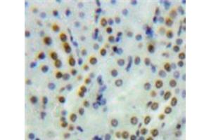 Used in DAB staining on fromalin fixed paraffin-embedded Kidney tissue (PYGO1 antibody  (AA 201-419))