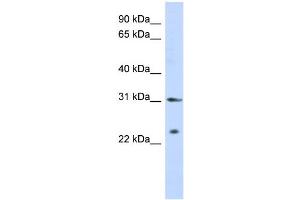 WB Suggested Anti-SSX5 Antibody Titration:  0. (SSX5 antibody  (Middle Region))