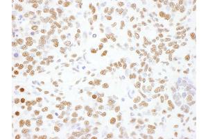 Immunohistochemistry (IHC) image for anti-Heterogeneous Nuclear Ribonucleoprotein L (HNRNPL) (AA 350-400) antibody (ABIN7795591)