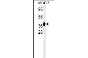 ATG4B/M antibody (ABIN659121 and ABIN2843761) western blot analysis in MCF-7 cell line lysates (35 μg/lane).
