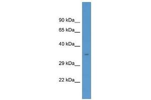 Western Blot showing MARCKS antibody used at a concentration of 1. (MARCKS antibody  (C-Term))