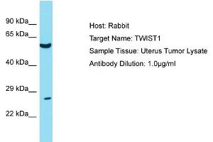 Host: Rabbit Target Name: TWIST1 Sample Tissue: Human Uterus Tumor Antibody Dilution: 1ug/ml (TWIST1 antibody  (N-Term))