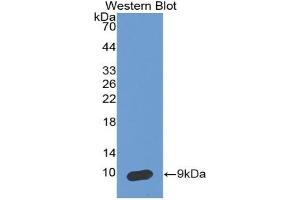 Detection of Recombinant SCCA2, Human using Monoclonal Antibody to Serpin Peptidase Inhibitor,Clade B,Member 4 (SERPINB4) (SERPINB4 antibody  (AA 144-298))