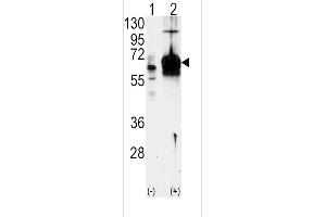 Western blot analysis of GUCY1A3 using GUCY1A3 Antibody using 293 cell lysates (2 ug/lane) either nontransfected (Lane 1) or transiently transfected with the GUCY1A3 gene (Lane 2). (GUCY1A1 antibody  (N-Term))
