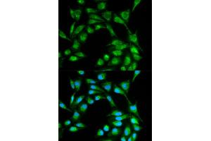 Immunofluorescence analysis of MCF-7 cells using ICOS antibody (ABIN5970917). (ICOS antibody)