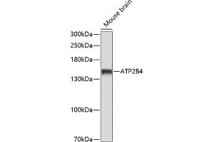 Western blot analysis of extracts of mouse brain, using B4 antibody (ABIN6127393, ABIN6137320, ABIN6137321 and ABIN6214232) at 1:1000 dilution.