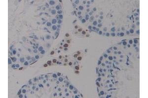 HMGN1 antibody  (AA 1-96)