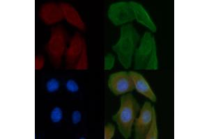 ABIN6261307 and ABIN6277247 staining Hela cells by IF/ICC.