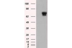 HEK293T cells were transfected with the pCMV6-ENTRY control (Left lane) or pCMV6-ENTRY PDE4A (Right lane) cDNA for 48 hrs and lysed. (PDE4A antibody)