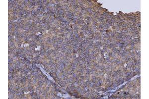 IHC analysis of ARL1 using anti-ARL1 antibody (ABIN7602848). (ARL1 antibody  (C-Term))