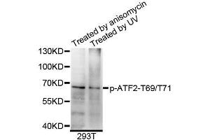 Western blot analysis of extracts of 293T cells, using Phospho-ATF2-T69/T71 antibody (ABIN5995600) at 1/1000 dilution. (ATF2 antibody  (pThr69, pThr71))