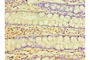 Immunohistochemistry of paraffin-embedded human colon tissue using ABIN7173568 at dilution of 1:100 (TNNC2 antibody  (AA 1-160))