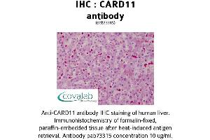 Image no. 1 for anti-Caspase Recruitment Domain Family, Member 11 (CARD11) (AA 18-238) antibody (ABIN1732634) (CARD11 antibody  (AA 18-238))