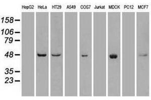 Image no. 3 for anti-Polo-Like Kinase 1 (PLK1) antibody (ABIN1500279) (PLK1 antibody)