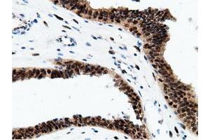 Image no. 17 for anti-EPM2A (Laforin) Interacting Protein 1 (EPM2AIP1) antibody (ABIN1498047) (EPM2AIP1 antibody)