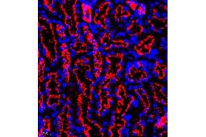 Immunofluorescence of paraffin embedded mouse kidney using eIF5A2 (ABIN7073893) at dilution of 1:300 (400x lens) (EIF5A2 antibody)
